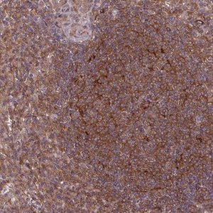Anti-SH3BGRL antibody produced in rabbit 