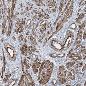 Anti-SH3BGRL3 antibody produced in rabbit 