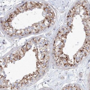 Anti-SH3BP5 antibody produced in rabbit 