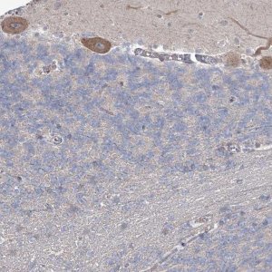 Anti-SH3BP5L antibody produced in rabbit 