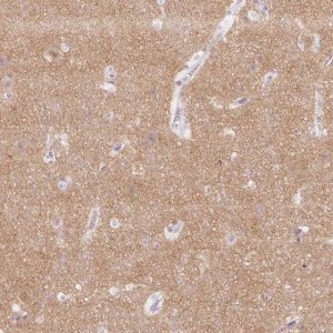 Anti-SH3GL2 antibody produced in rabbit 