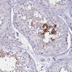 Anti-SH3GL3 antibody produced in rabbit 