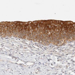 Anti-SH3GLB2 antibody produced in rabbit 