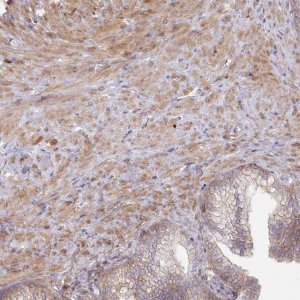Anti-SH3PXD2B antibody produced in rabbit 