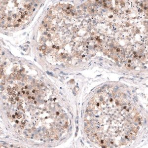 Anti-SHOC2 antibody produced in rabbit 