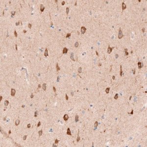 Anti-SHOC2 antibody produced in rabbit 
