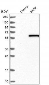 Anti-SHPK antibody produced in rabbit HPA024361-100UL