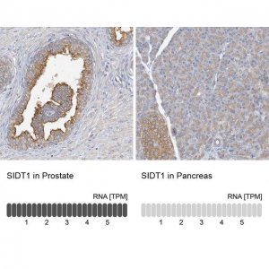 Anti-SIDT1 antibody produced in rabbit 