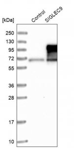 Anti-SIGLEC9 antibody produced in rabbit HPA010682-100UL