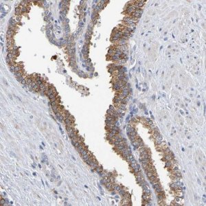 Anti-SIL1 antibody produced in rabbit 