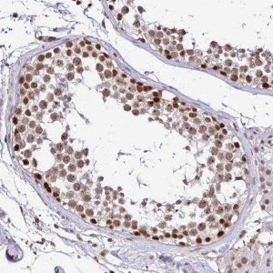 Anti-SIN3A antibody produced in rabbit 