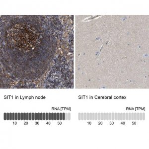 Anti-SIT1 antibody produced in rabbit 
