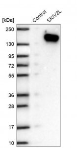 Anti-SKIV2L antibody produced in rabbit HPA051959-100UL
