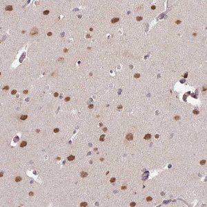 Anti-SKIV2L antibody produced in rabbit HPA051959-100UL