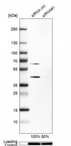 Anti-SKP2 antibody produced in rabbit HPA051196-100UL