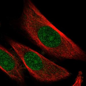 Anti-SKP2 antibody produced in rabbit HPA051196-100UL