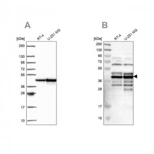 Anti-SLBP antibody produced in rabbit 
