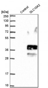 Anti-SLC10A2 antibody produced in rabbit 