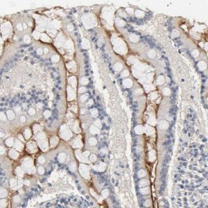Anti-SLC10A2 antibody produced in rabbit 