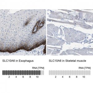 Anti-SLC10A6 antibody produced in rabbit 