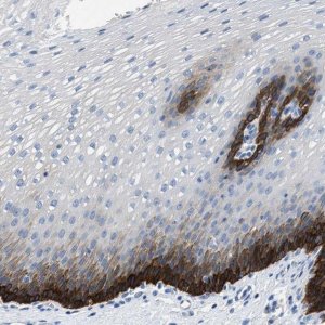 Anti-SLC10A6 antibody produced in rabbit 