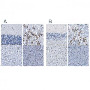 Anti-SLC12A1 antibody produced in rabbit 