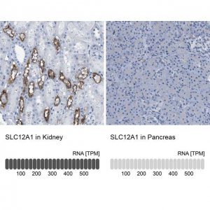 Anti-SLC12A1 antibody produced in rabbit 