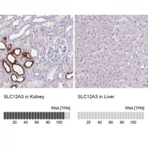 Anti-SLC12A3 antibody produced in rabbit 