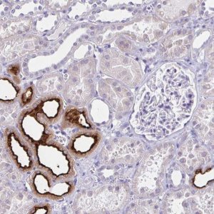 Anti-SLC12A3 antibody produced in rabbit 