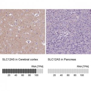Anti-SLC12A5 antibody produced in rabbit 