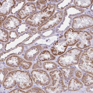 Anti-SLC13A1 antibody produced in rabbit 