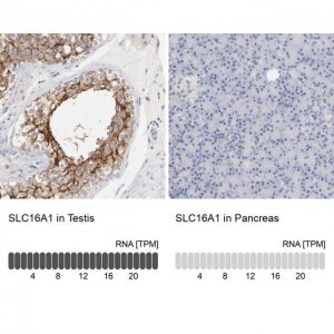 Anti-SLC16A1 antibody produced in rabbit 