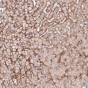 Anti-SLC16A2 antibody produced in rabbit 
