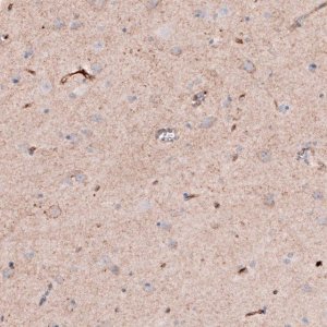 Anti-SLC16A2 antibody produced in rabbit 