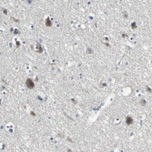 Anti-SLC16A7 antibody produced in rabbit 
