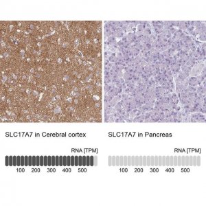Anti-SLC17A7 antibody produced in rabbit 