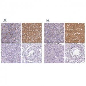 Anti-SLC17A7 antibody produced in rabbit 