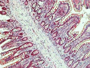 Anti-SLC1A1 antibody produced in rabbit SAB4200518-200UL