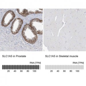 Anti-SLC1A5 antibody produced in rabbit 