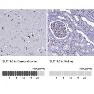 Anti-SLC1A6 antibody produced in rabbit 