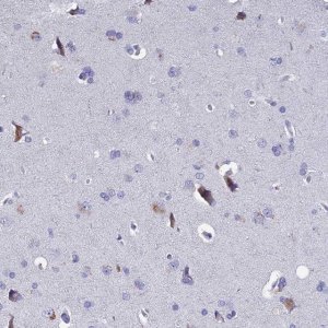 Anti-SLC1A6 antibody produced in rabbit 