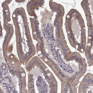 Anti-SLC22A18 antibody produced in rabbit 