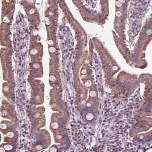 Anti-SLC22A18AS antibody produced in rabbit 