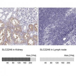 Anti-SLC22A6 