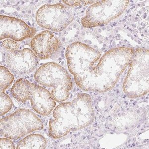 Anti-SLC22A8 antibody produced in rabbit 