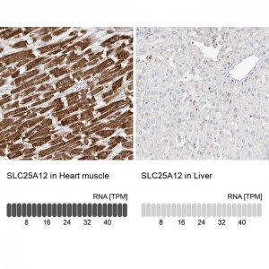 Anti-SLC25A12 antibody produced in rabbit 