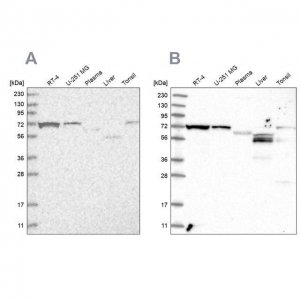 Anti-SLC25A12 antibody produced in rabbit 