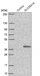 Anti-SLC25A16 antibody produced in rabbit HPA044580-100UL