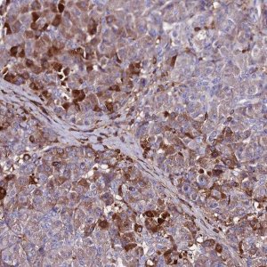 Anti-SLC25A16 antibody produced in rabbit HPA044580-100UL