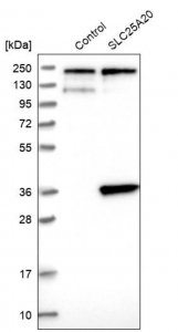 Anti-SLC25A20 antibody produced in rabbit 
